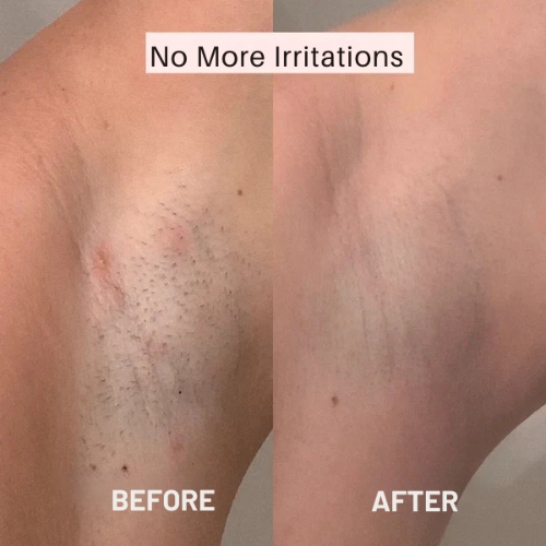 Γυναικείο ξυράφι - Λείο δέρμα χωρίς ερεθισμούς 